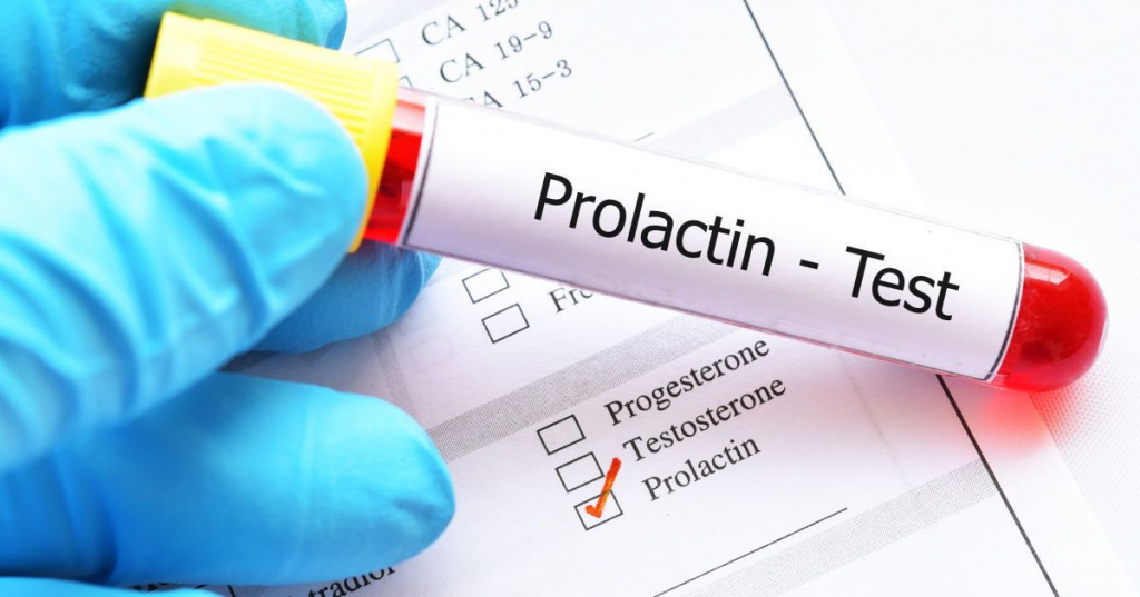 Пролактин: информация о гормоне, значения нормы и увеличенного содержания данного вещества в крови. Почему развиваются и как проявляются такие нарушения