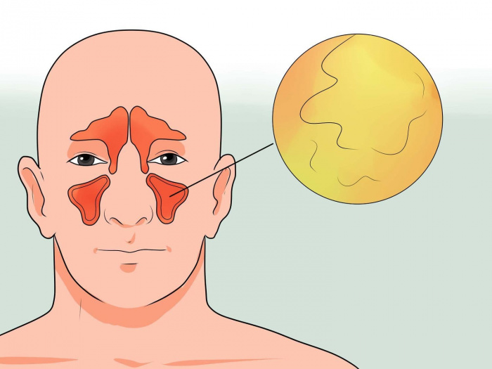 Как эффективно прочистить пазухи носа: проверенные способы