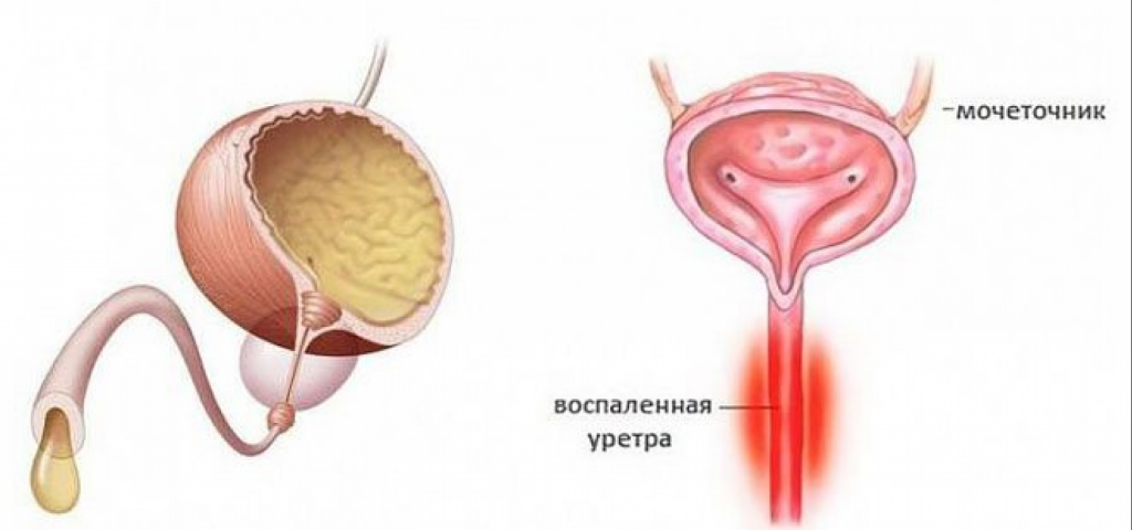 Уретра это что такое у женщины