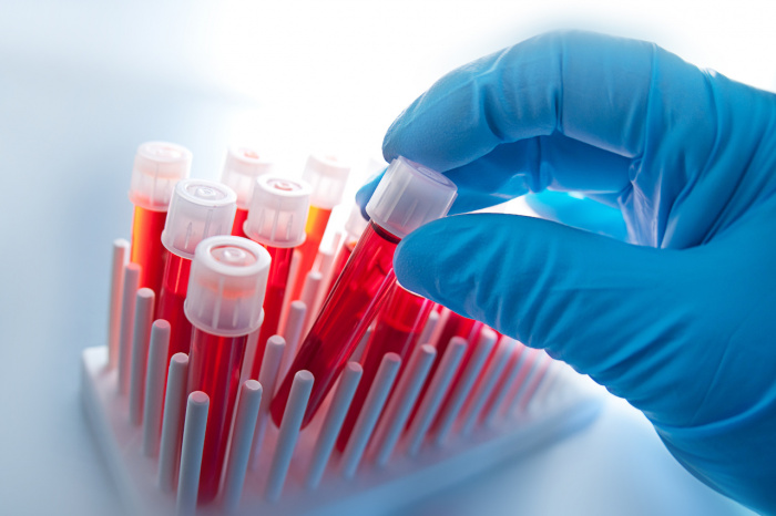Биохимический анализ крови: показания и расшифровка