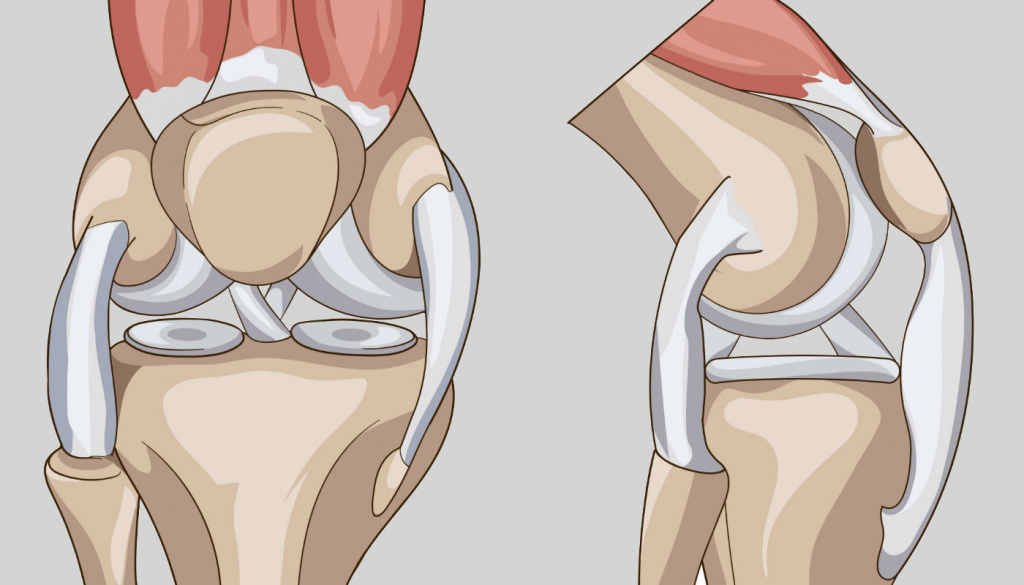 Трещина в мениске коленного сустава чем лечить дома