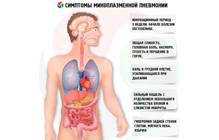 Признаки пневмонии у взрослого без температуры