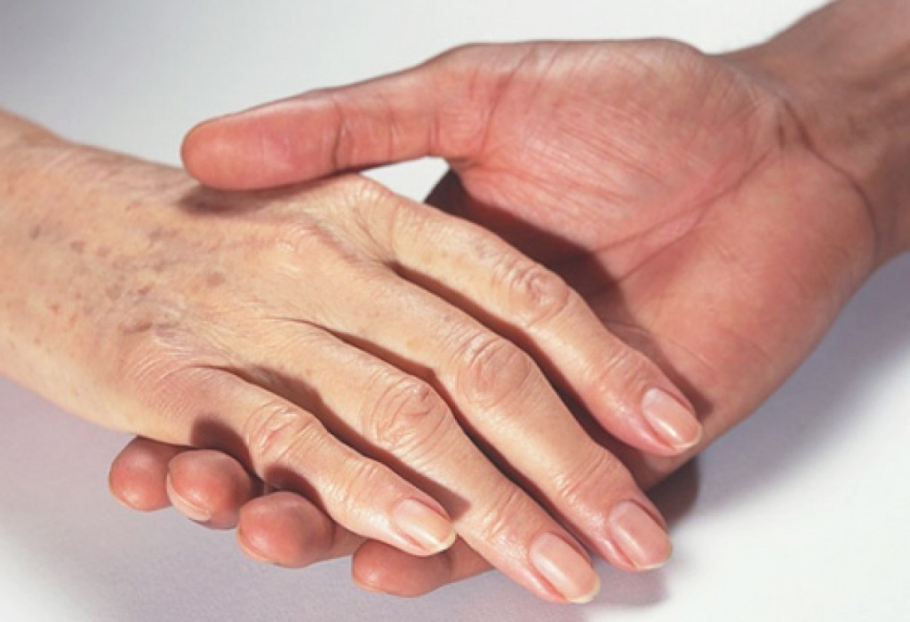 Почему руки стареют быстрее: основные причины и методы борьбы 
